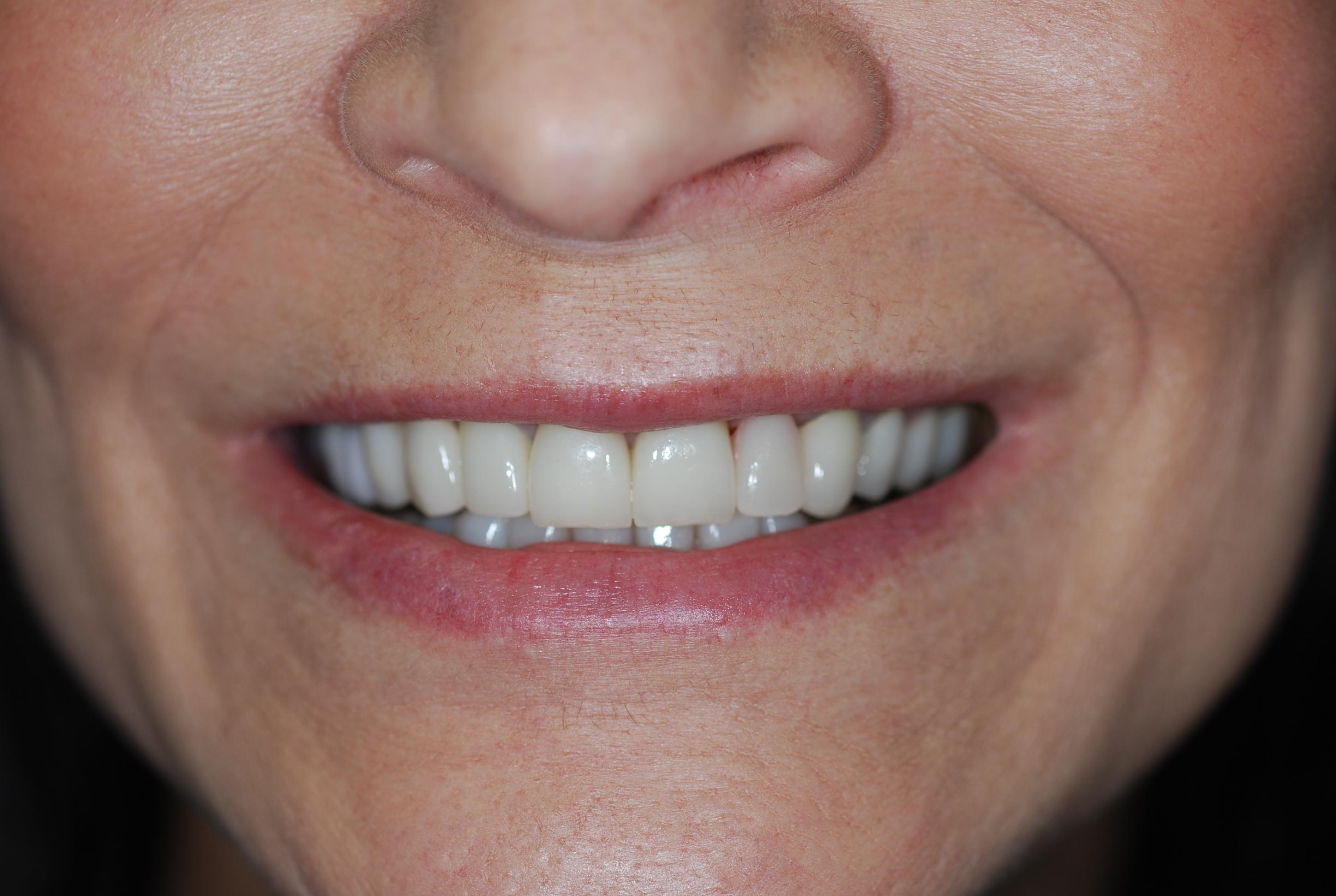 Premier Oral Facial & Implant Surgery Image