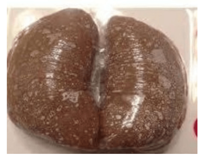 Amala