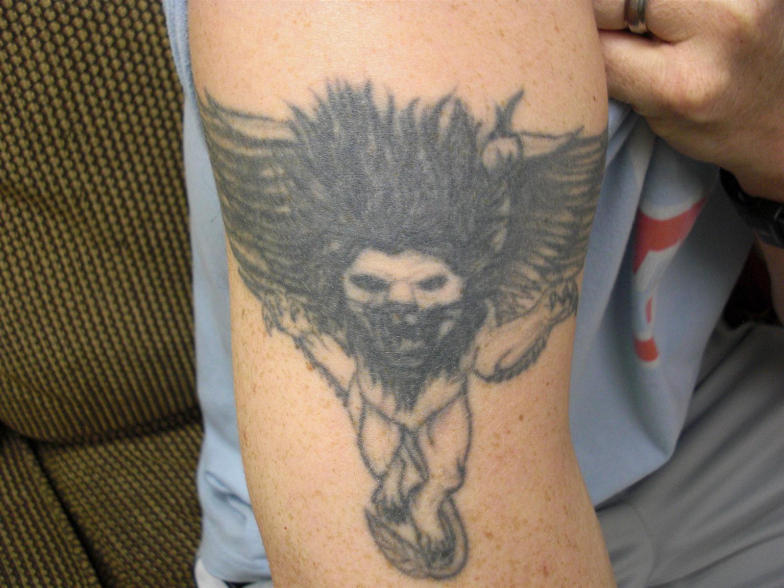 medermis laser tattoo removal san antonio tx business medermis laser tattoo removal san antonio tx business
