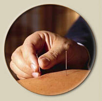 Marcy Wilson Acupuncture Photo