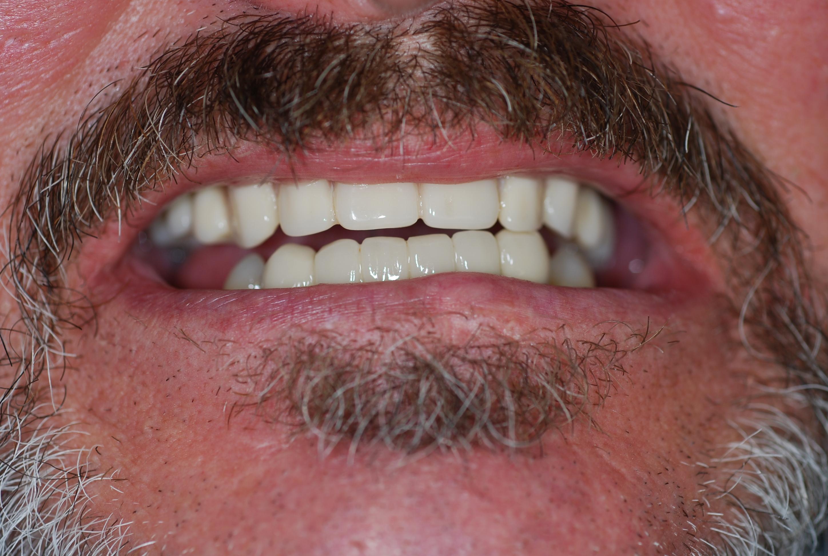 Premier Oral Facial & Implant Surgery Image