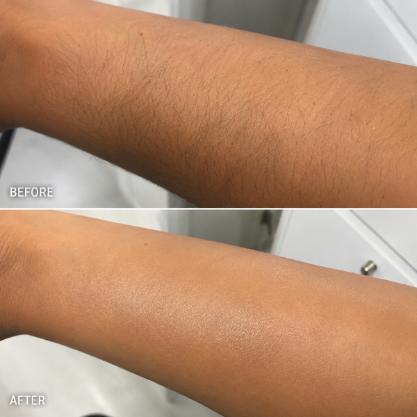 Half Arm Waxing