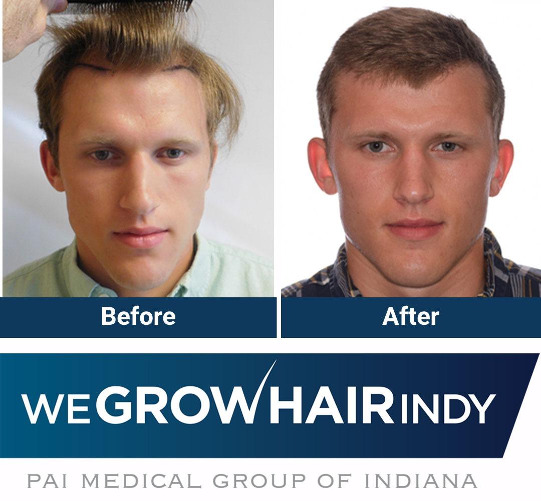 We Grow Hair Indy Photo