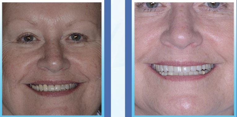 Images Max L Lingo, DDS