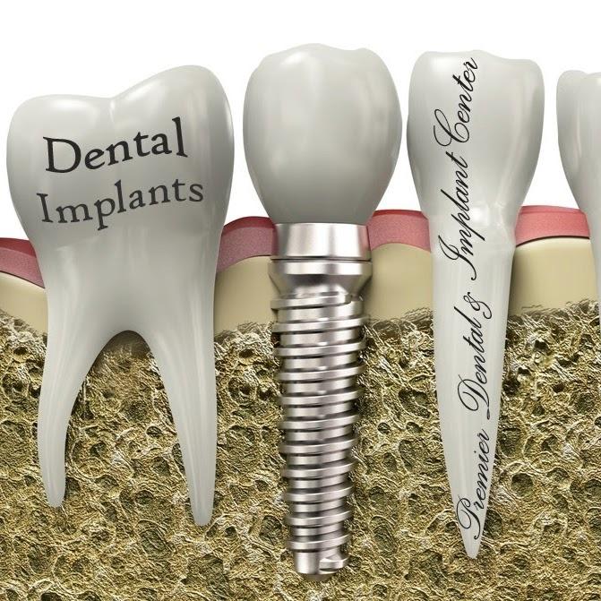 Premier Dental & Implant Center