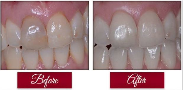 Images Max L Lingo, DDS