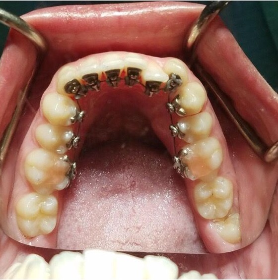Upland Dental Implant and Orthodontics Photo