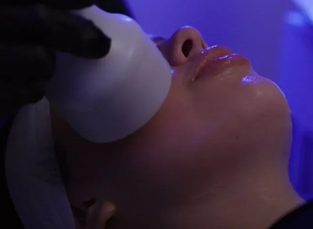 Cryofacial