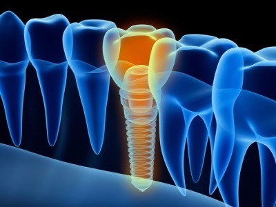 Images Fisiodont