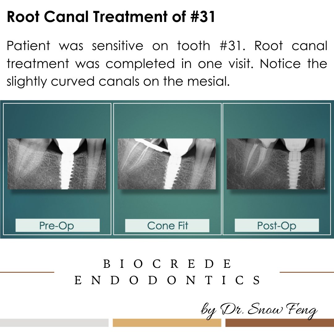 Biocrede Endodontics Image