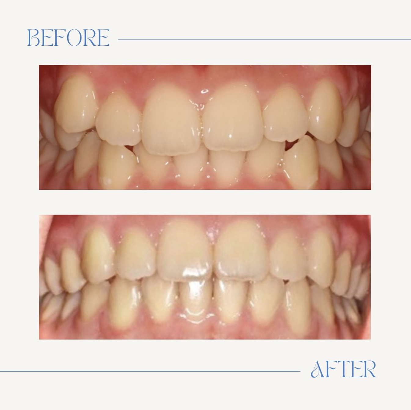 Boschken Orthodontics Image