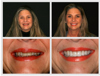 Images Konig Center for Cosmetic & Comprehensive Dentistry