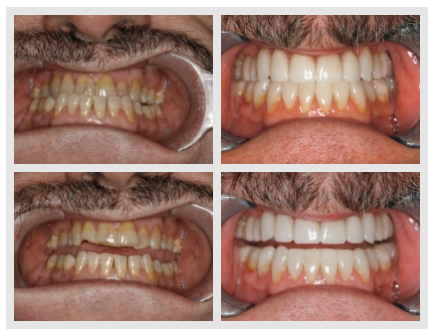 Images Konig Center for Cosmetic & Comprehensive Dentistry