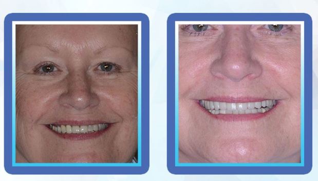Images Max L Lingo, DDS