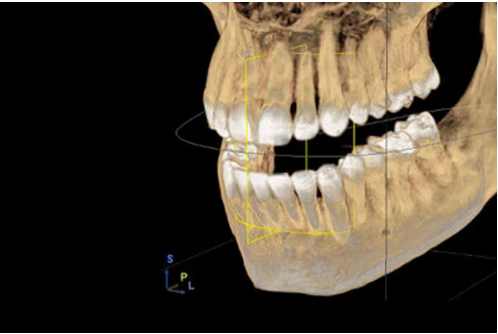 Radiografia dentale 3D