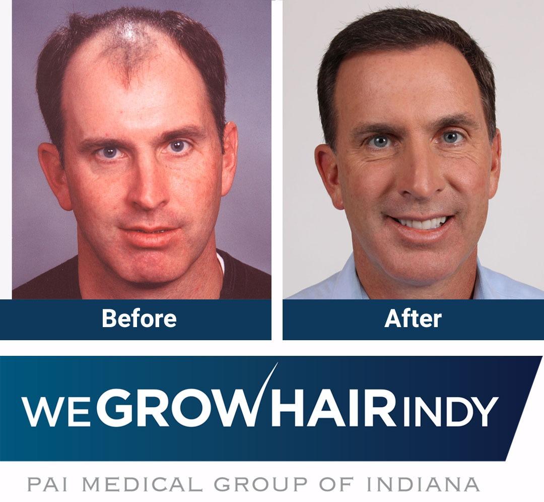 We Grow Hair Indy Photo