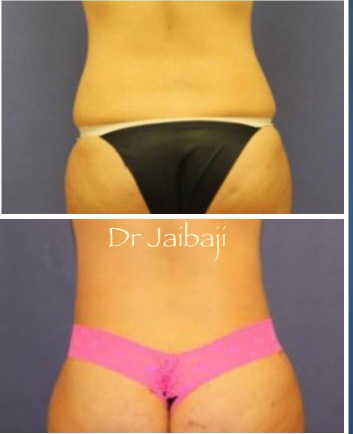 Jaibaji Plastic Surgery Photo