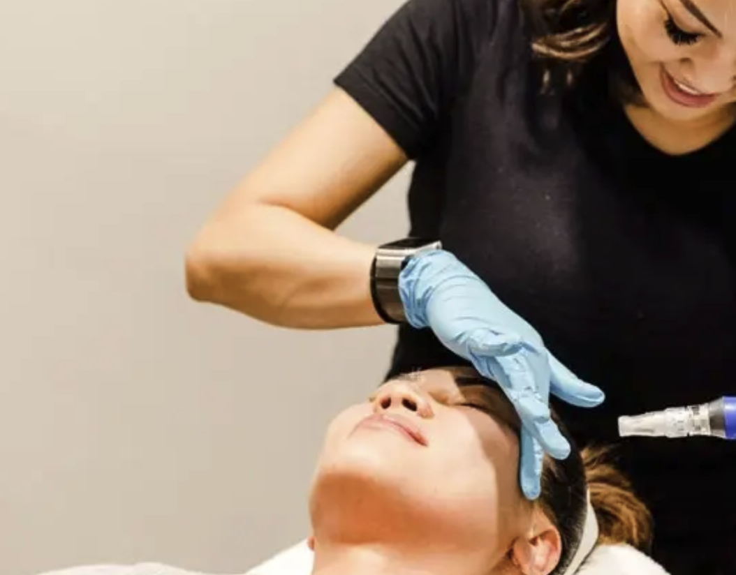Microneedling