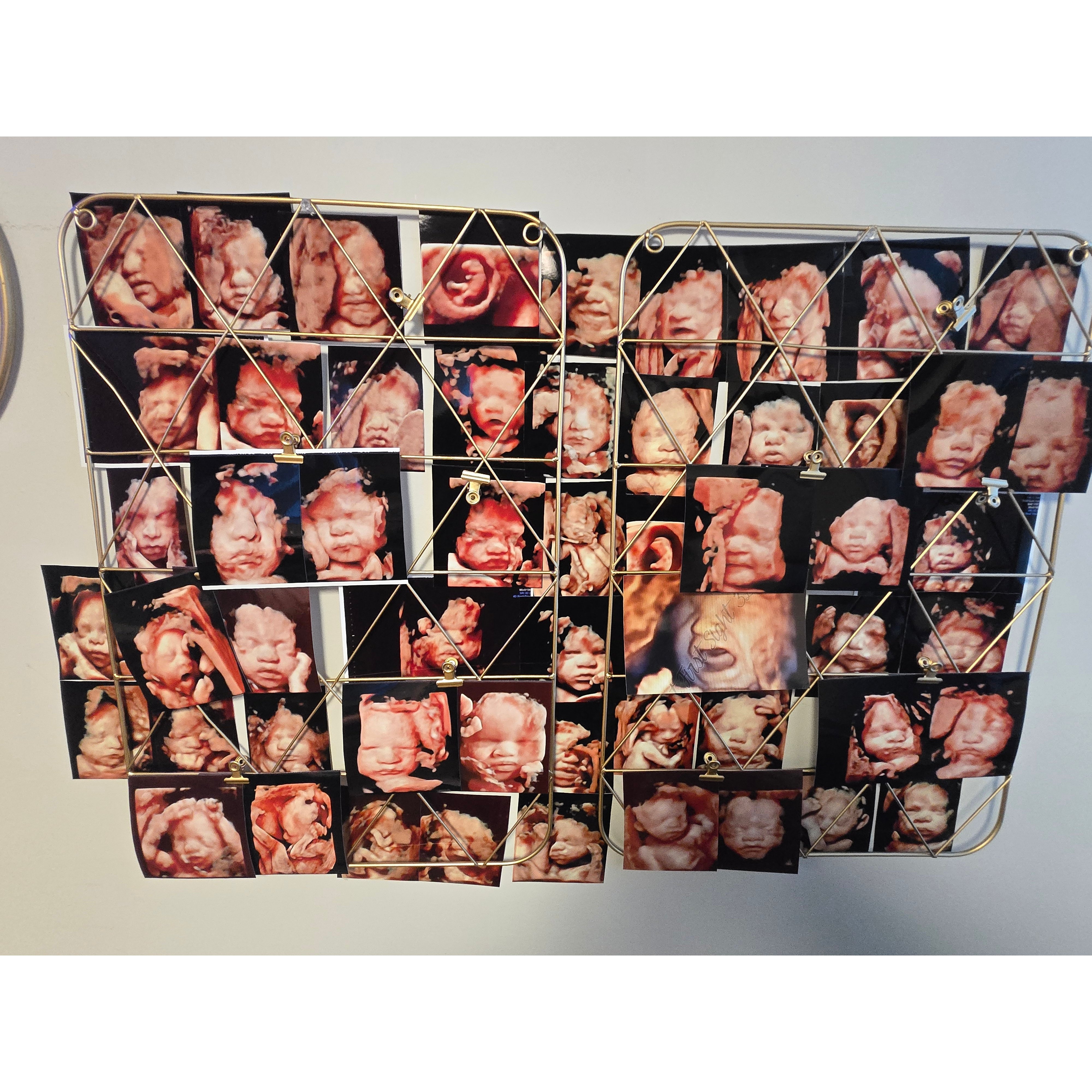 Love At First Sight 3D/4D Ultrasound Imaging Studio, LLC
