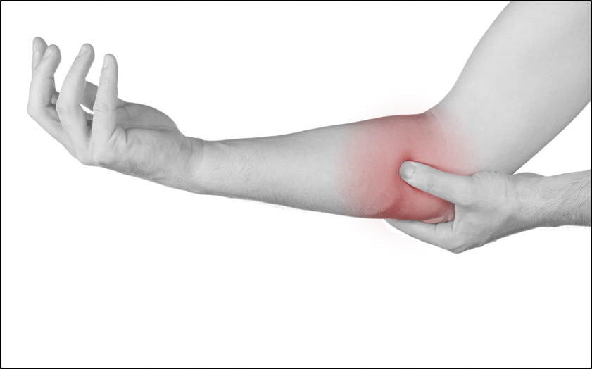 Golfer's Elbow Golfer's Elbow is a term describing the overuse of the muscles in the forearm and wrist that enable an individual to clench, rotate, grip and flex their wrists and hands. Repeatedly using these muscles may cause microscopic tears in the tendons that connect to the boney inside region of the elbow. This pain in the elbow then may spread and radiate down to the forearm and wrist areas. Causes This condition can either gradually develop or happen after one incident. The term 