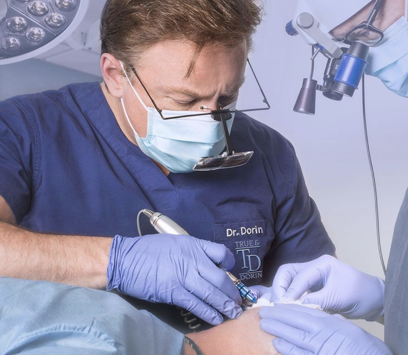 Follicular Unit Extraction (FUE)