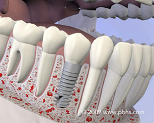 Raska Dental Implant & Oral Surgery Photo