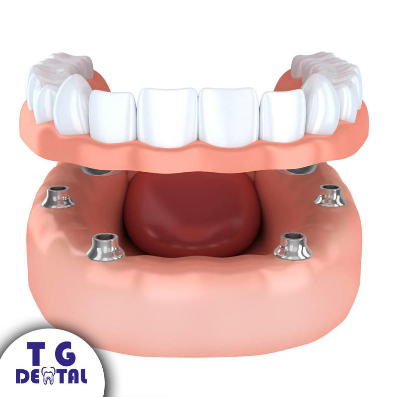Images T.G. Dental