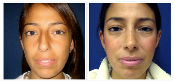 Alizadeh Cosmoplastic Surgery Photo