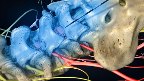 Images Alicia R. Carter, MD | Integrative Spine & Orthopedic Rehabilitation