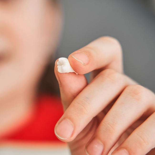 Tooth Extraction