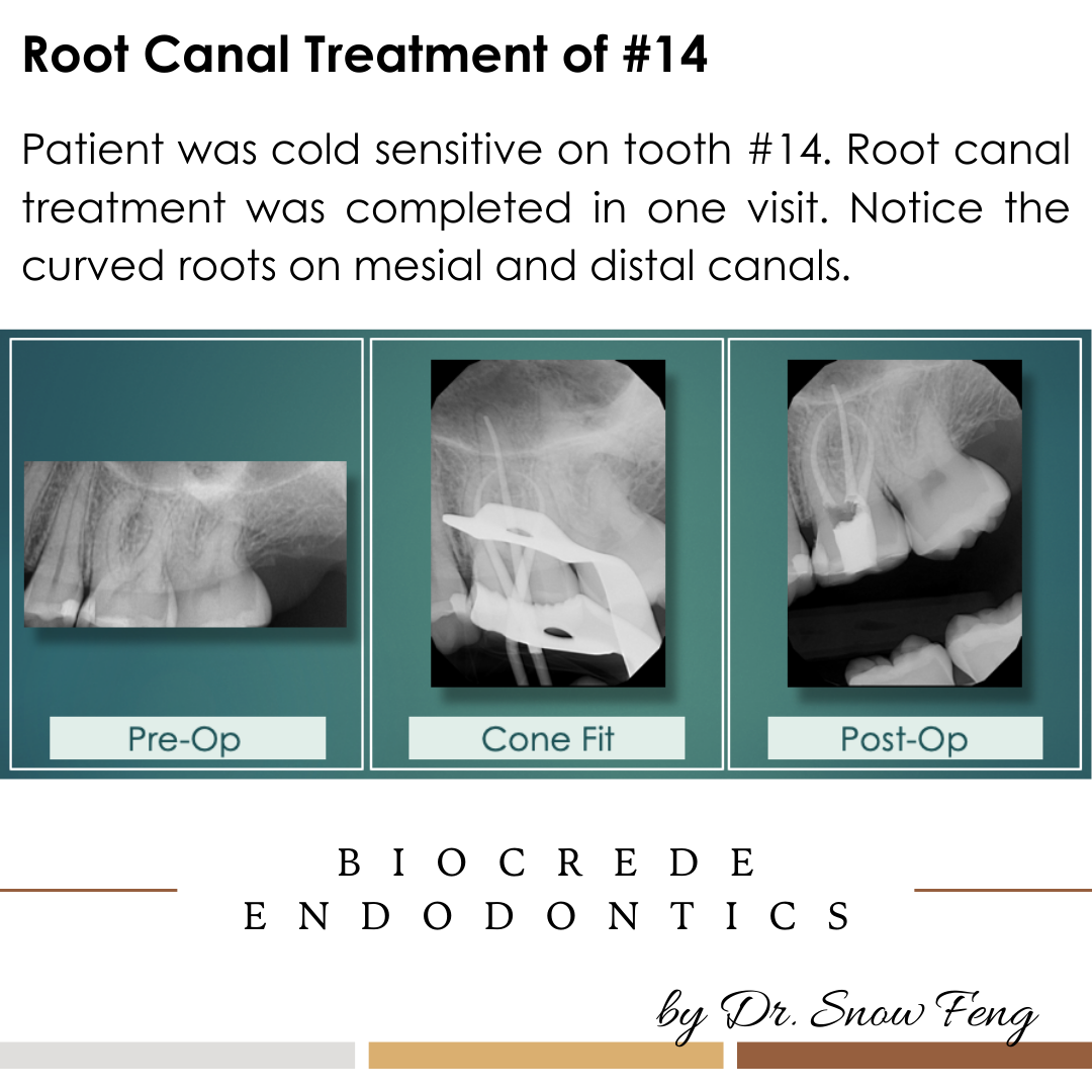 Biocrede Endodontics Image