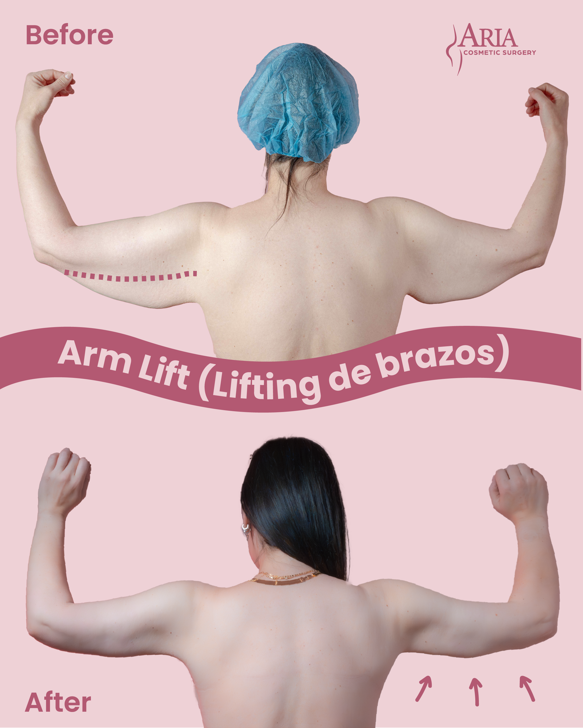 Aria Cosmetic Surgery Image