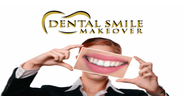 Dental Smile Makeover Photo