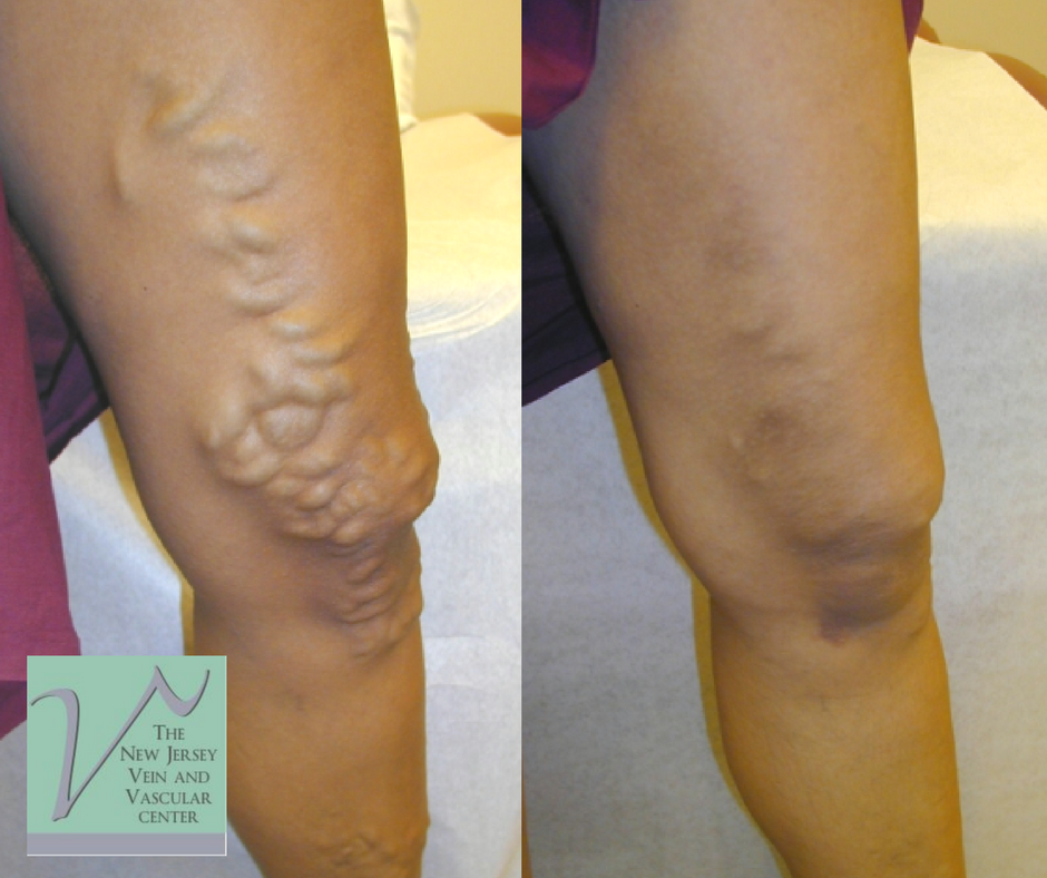 The New Jersey Vein & Vascular Center Photo