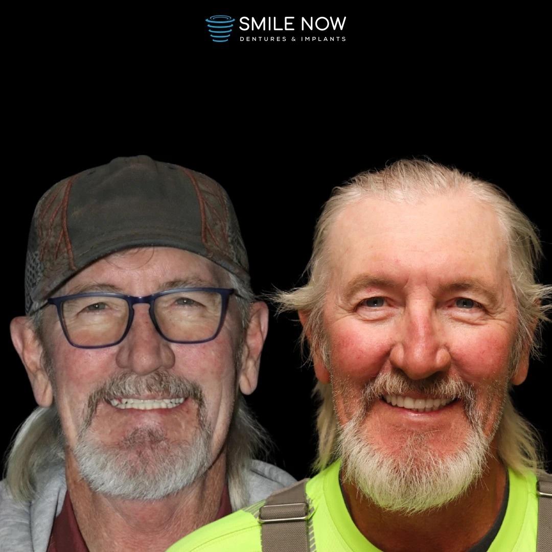 Smile Now Boise Dentures and Implants Image