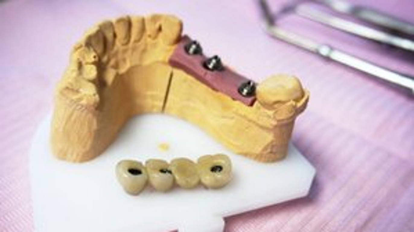 Gallery thumbnail