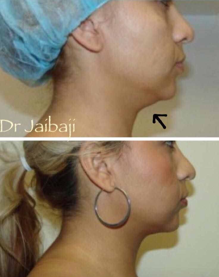 Jaibaji Plastic Surgery Photo