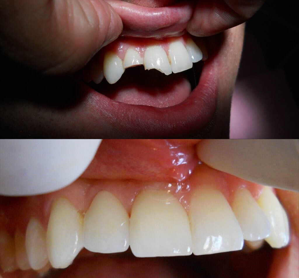 Precision Dental Ceramics Image