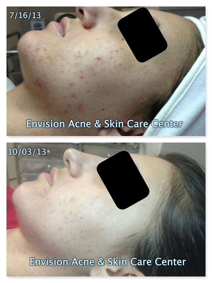 Envision Acne & Skin Care Center Photo