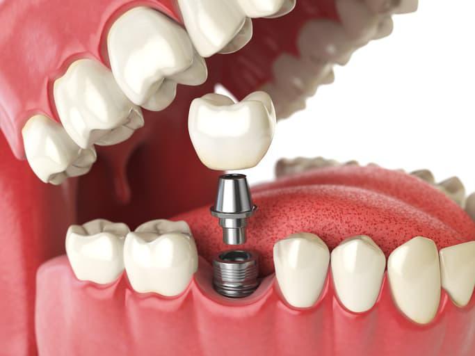 Images Studio Dentistico Cappelli