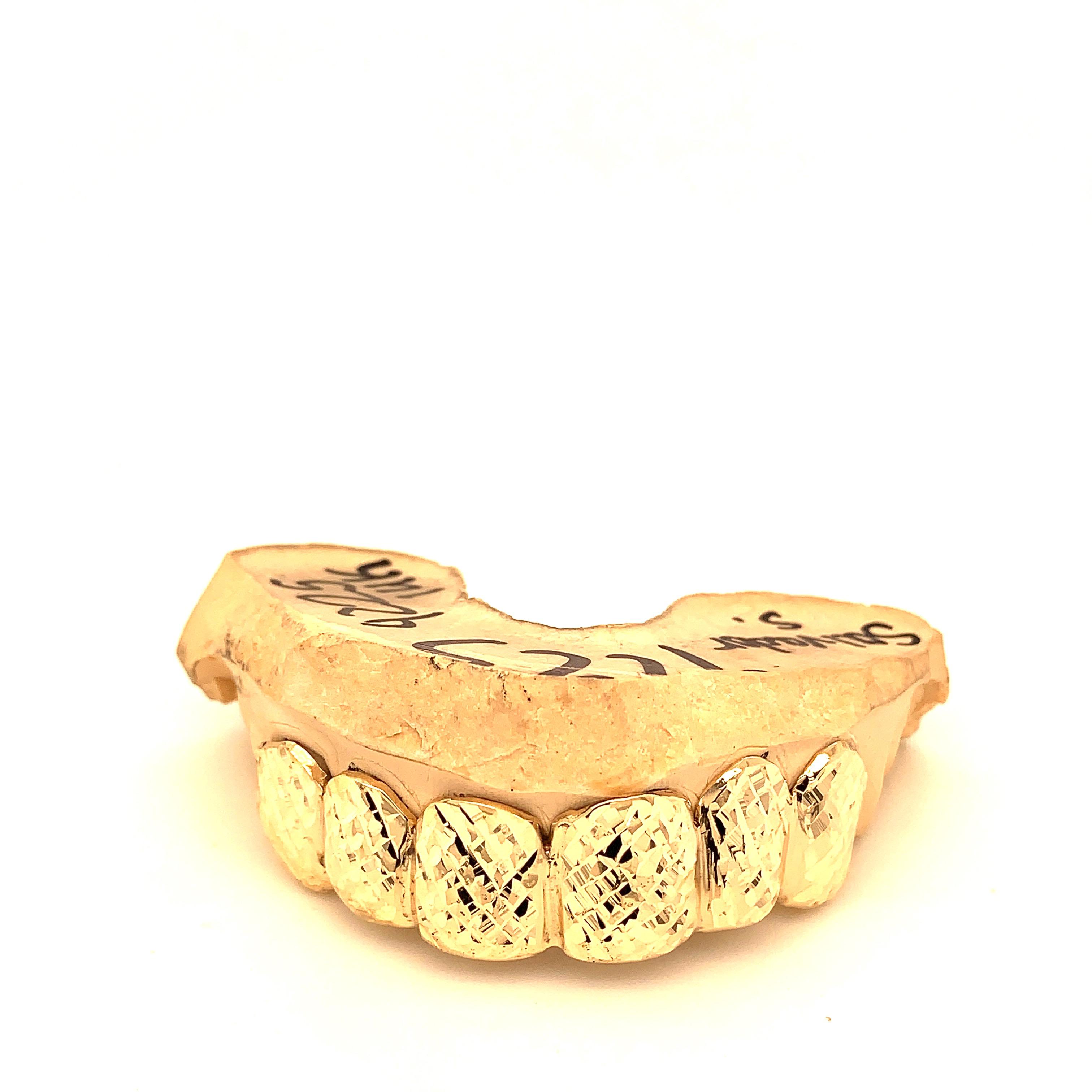 Seattle Gold Grills Photo