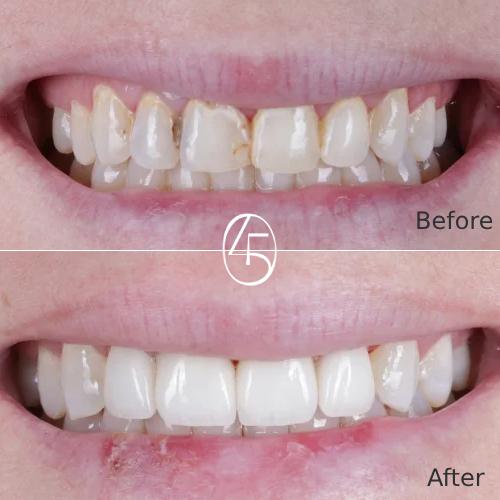 405 Dental Aesthetics Image