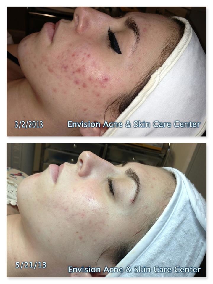 Envision Acne & Skin Care Center Photo