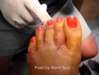 Best Foot Doctor NY Photo