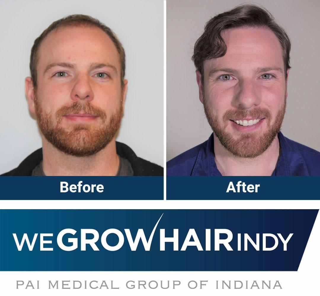 We Grow Hair Indy Photo
