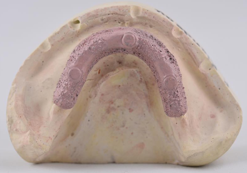 Images Laboratoire Dentaire 3R
