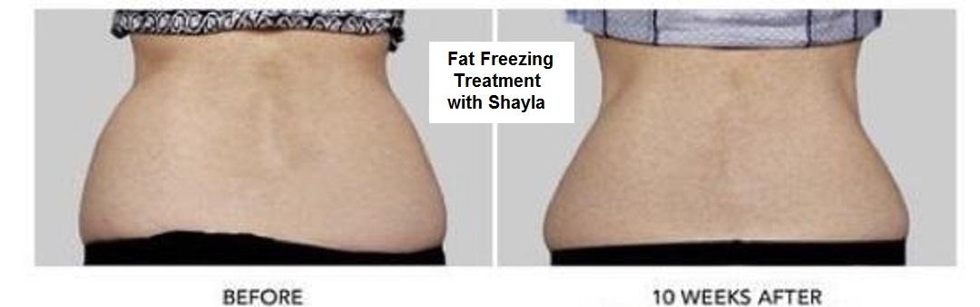 Permatech Makeup Image