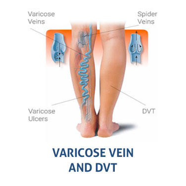 Images Vein Expert