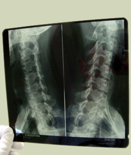 Palmer Chiropractic Center