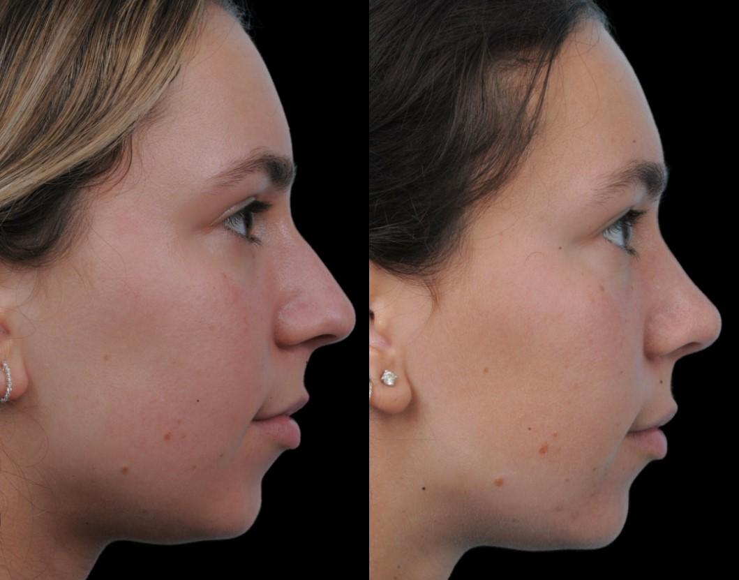 Facial Surgery Institute of Boca Raton